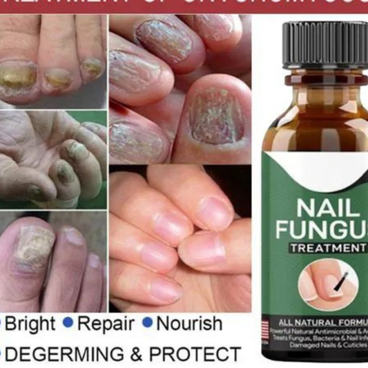 Nail